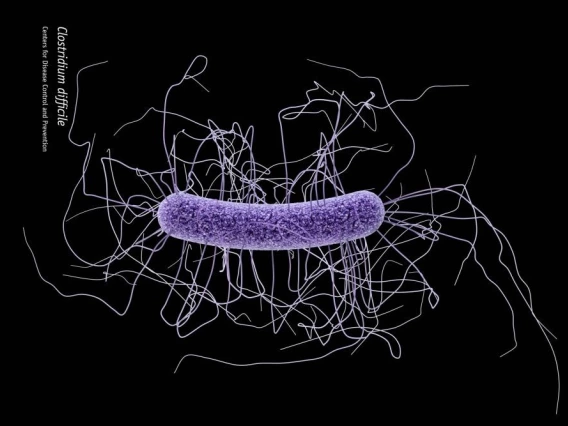Clostridium difficile CDC
