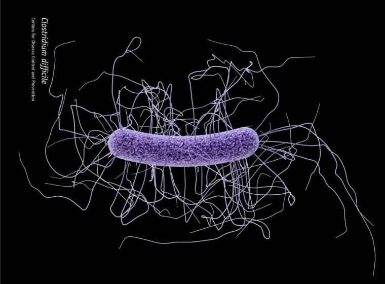 Clostridium difficile CDC