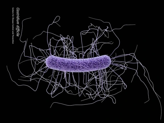 Clostridium difficile CDC